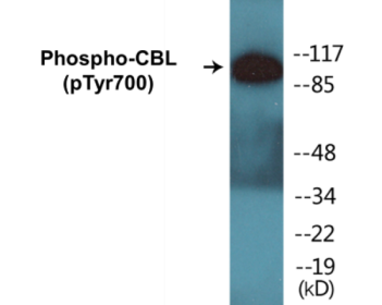 Western blot analysis of extracts from K562 cells treated with Na3VO4 0.3nM, using CBL (Phospho-Tyr700) Antibody.