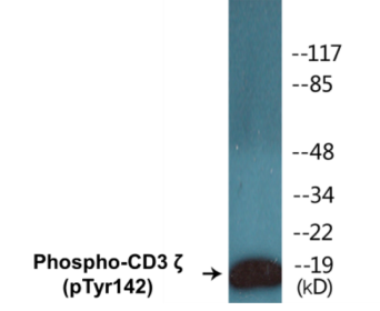 Western blot analysis of extracts from Jurkat cells treated with UV 15', using CD3 zeta (Phospho-Tyr142) Antibody.