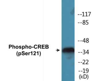 Western blot analysis of extracts from HeLa cells treated with Etoposide 25uM 24h, using CREB (Phospho-Ser121) Antibody.