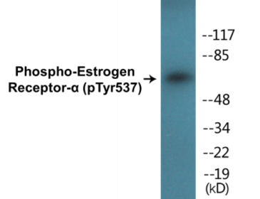 Western blot analysis of extracts from 293 cells, using Estrogen Receptor-alpha (Phospho-Tyr537) Antibody.