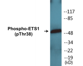Western blot analysis of extracts from HeLa cells treated with Serum 20% 15', using ETS1 (Phospho-Thr38) Antibody.