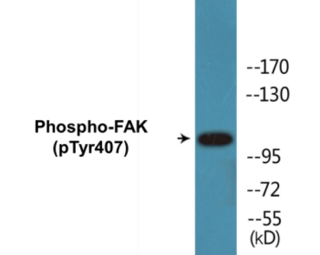 Western blot analysis of extracts from COS7 cells treated with EGF 200ng/ml 30', using FAK (Phospho-Tyr407) Antibody.