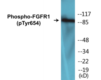 Western blot analysis of extracts from 293 cells treated with Insulin 0.01U/ml 15', using FGFR1 (Phospho-Tyr654) Antibody. The lane on the right is treated with the synthesized peptide.