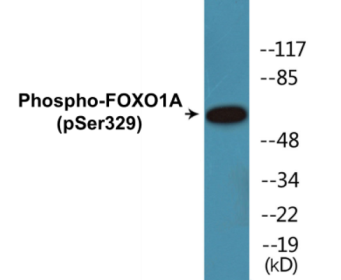 Western blot analysis of extracts from HeLa cells treated with Serum 20% 15', using FOXO1A (Phospho-Ser329) Antibody.