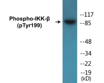Western blot analysis of extracts from HeLa cells treated with TNF-a 20ng/ml+Calyculin A 50nM 5', using IKK-beta (Phospho-Tyr199) Antibody.