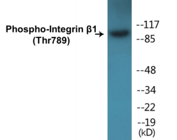 Western blot analysis of extracts from HepG2 cells treated with Ca2+ 40uM 30', using Integrin beta1 (Phospho-Thr789) Antibody.