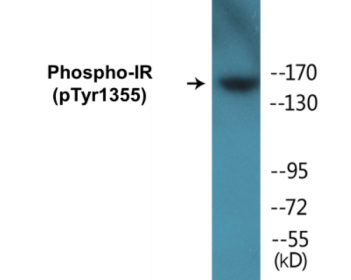 Western blot analysis of extracts from 293 cells treated with Heat shock, using IR (Phospho-Tyr1355) Antibody.