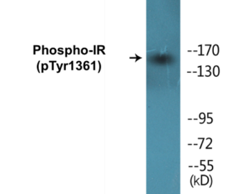Western blot analysis of extracts from 293 cells treated with Heat shock, using IR (Phospho-Tyr1361) Antibody.