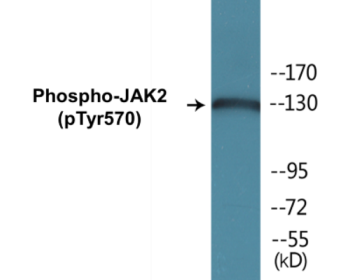 Western blot analysis of extracts from 293 cells treated with etoposide 25uM 24h, using JAK2 (Phospho-Tyr570) Antibody.