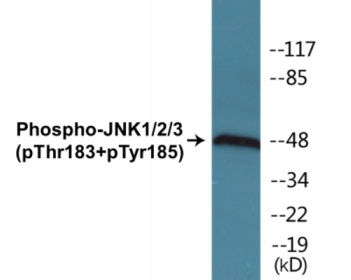 Western blot analysis of extracts from 293 cells treated with UV 5', using JNK1/2/3 (Phospho-Thr183+Tyr185) Antibody.