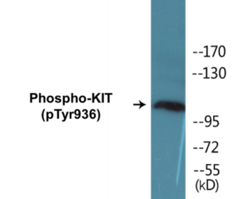 Western blot analysis of extracts from HepG2 cells treated with EGF 200ng/ml 30', using KIT (Phospho-Tyr936) Antibody.