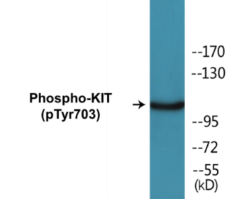 Western blot analysis of extracts from HepG2 cells treated with EGF 200ng/ml 30', using KIT (Phospho-Tyr703) Antibody.