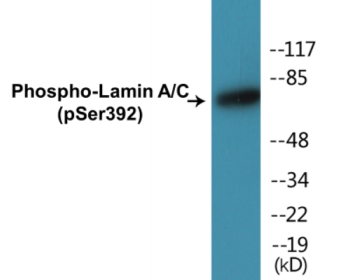 Western blot analysis of extracts from HeLa cells, using Lamin A/C (Phospho-Ser392) Antibody.