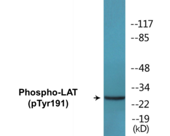 Western blot analysis of extracts from NIH-3T3 cells, using LAT (Phospho-Tyr191) Antibody.