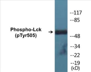 Western blot analysis of extracts from Jurkat cells, using Lck (Phospho-Tyr505) Antibody.
