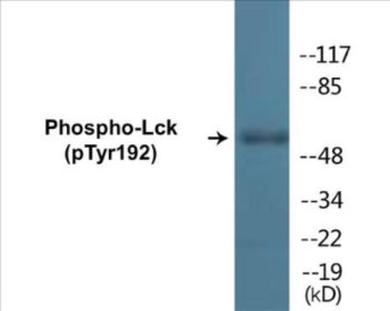 Western blot analysis of extracts from Jurkat cells, using Lck (Phospho-Tyr192) Antibody.