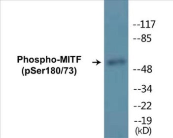 Western blot analysis of extracts from COS7 cells, using MITF (Phospho-Ser180/73) Antibody.