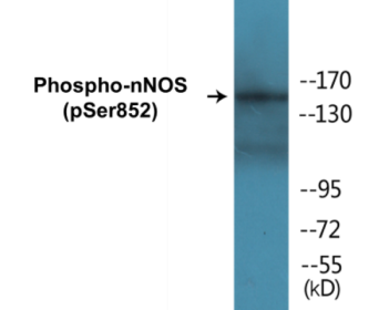 Western blot analysis of extracts from HeLa cells treated with Ca+ 40nM 30', using NFAT4 (Phospho-Ser165) Antibody.