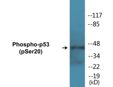 Western blot analysis of extracts from Jurkat cells treated with UV 15', using NMDAR2B (Phospho-Tyr1474) Antibody.