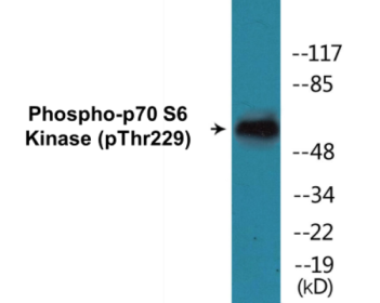 Western blot analysis of extracts from A549 cells, using n-NOS (Phospho-Ser852) Antibody.