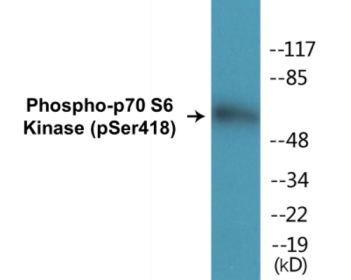 Western blot analysis of extracts from HT29 cells treated with serum 20% 15', using p70 S6 Kinase (Phospho-Ser418) Antibody.