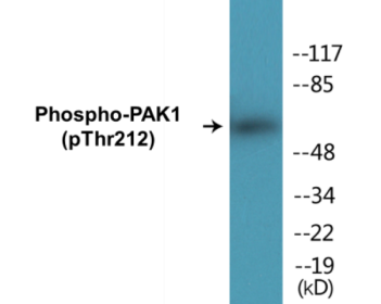 Western blot analysis of extracts from 293 cells treated with etoposide 25uM 1h, using PAK1 (Phospho-Thr212) Antibody.