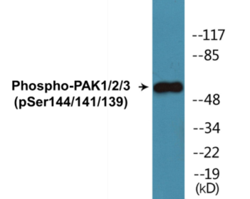 Western blot analysis of extracts from mouse brain, using PAK1/2/3 (Phospho-Ser144/141/139) Antibody.