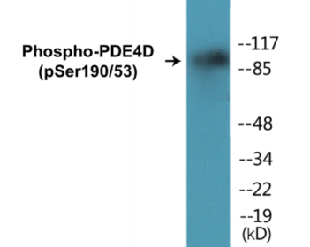Western blot analysis of extracts from K562 cells treated with H2O2 100uM 30', using PDE4D (Phospho-Ser190/53) Antibody.
