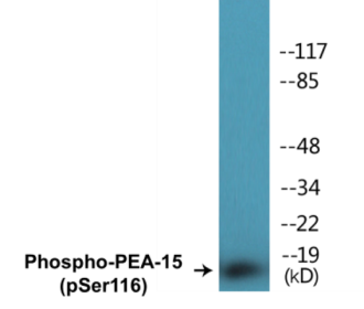 Western blot analysis of extracts from COS7 cells treated with INSULIN 0.01U/ML 15', using PEA-15 (Phospho-Ser116) Antibody.