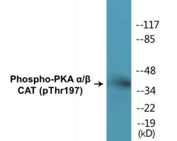Western blot analysis of extracts from mouse brain, using PKA CAT (Phospho-Thr197) Antibody.