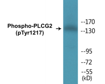 Western blot analysis of extracts from Jurkat cells treated with UV 15', using PLCG2 (Phospho-Tyr1217) Antibody.