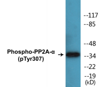 Western blot analysis of extracts from A549 cells, using PP2A-alpha (Phospho-Tyr307) Antibody.