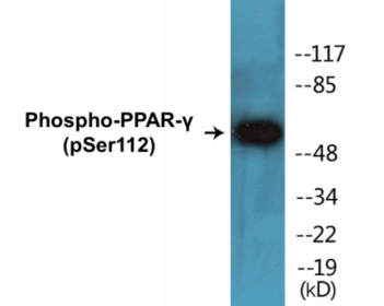 Western blot analysis of extracts from Jurkat cells treated with Paclitaxel 1uM 24h, using PPAR-gamma (Phospho-Ser112) Antibody.