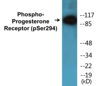 Western blot analysis of extracts from 293 cells treated with Etoposide 25uM 60', using Progesterone Receptor (Phospho-Ser294) Antibody.