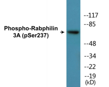 Western blot analysis of extracts from RAW264.7 cells treated with Calyculin 100nM 15', using Rabphilin 3A (Phospho-Ser237) Antibody.