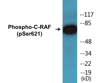 Western blot analysis of extracts from HeLa cells treated with UV 5', using C-RAF (Phospho-Ser621) Antibody.