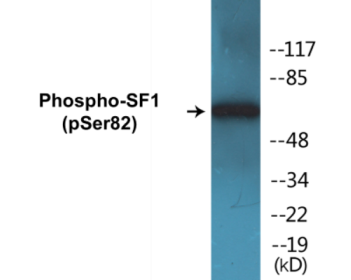 Western blot analysis of extracts from HuvEc cells treated with anisomycin 25ug/ml 30', using SF1 (Phospho-Ser82) Antibody.
