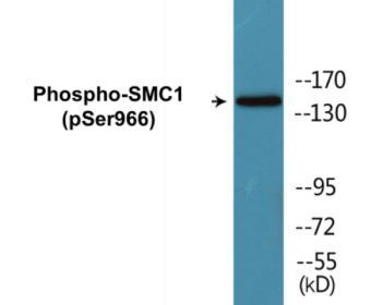 Western blot analysis of extracts from HuvEc cells treated with etoposide 24uM 24h, using SMC1 (Phospho-Ser966) Antibody.