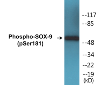 Western blot analysis of extracts from 293 cells treated with PBS 60', using SOX-9 (Phospho-Ser181) Antibody.