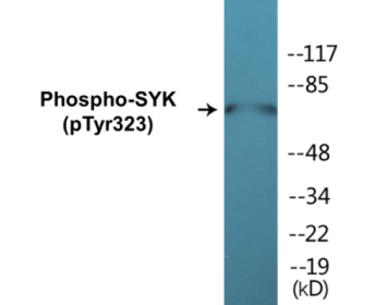 Western blot analysis of extracts from HT29 cells, using SYK (Phospho-Tyr323) Antibody.