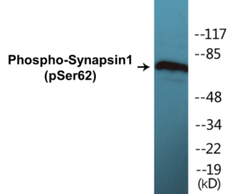 Western blot analysis of extracts from HeLa cells treated with Anisomycin 25ug/ml 30', using Synapsin1 (Phospho-Ser62) Antibody.
