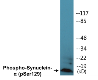 Western blot analysis of extracts from mouse brain, using Synuclein (Phospho-Ser129) Antibody.