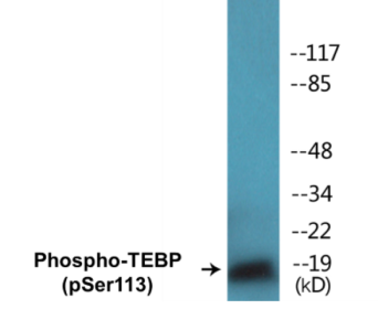 Western blot analysis of extracts from NIH-3T3 cells treated with EGF 200ng/ml 30', using TEBP (Phospho-Ser113) Antibody.