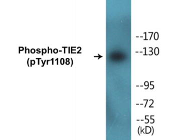 Western blot analysis of extracts from NIH-3T3 cells, using TIE2 (Phospho-Tyr1108) Antibody.