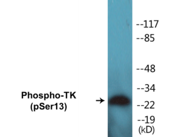 Western blot analysis of extracts from HeLa cells treated with paclitaxel 1uM 24h, using TK (Phospho-Ser13) Antibody.