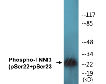 Western blot analysis of extracts from mouse heart, using TNNI3 (Phospho-Ser22+Ser23) Antibody.