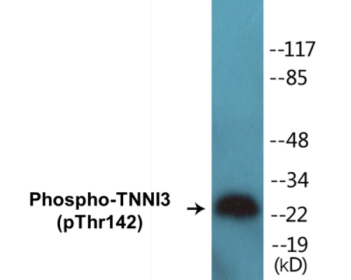 Western blot analysis of extracts from mouse heart, using TNNI3 (Phospho-Thr142) Antibody.