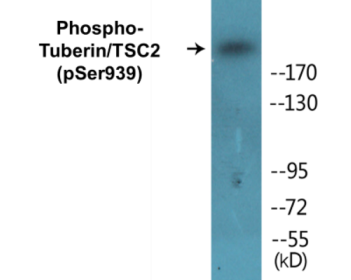 Western blot analysis of extracts from 293 cells treated with Anisomycin 25ug/ml 30', using Tuberin/TSC2 (Phospho-Ser939) Antibody.