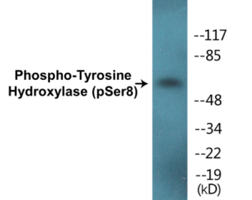 Western blot analysis of extracts from HepG2 cells treated with Anisomycin 25ug/ml 30', using Tyrosine Hydroxylase (Phospho-Ser8) Antibody.