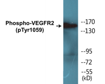 Western blot analysis of extracts from HepG2 cells treated with Na3VO4 0.3nM 40', using VEGFR2 (Phospho-Tyr1059) Antibody.